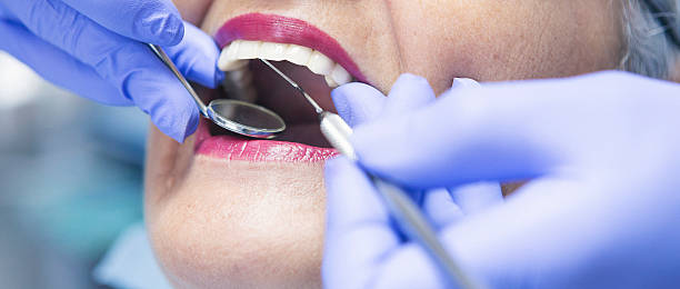 Best Emergency Tooth Extraction in Stedman, NC